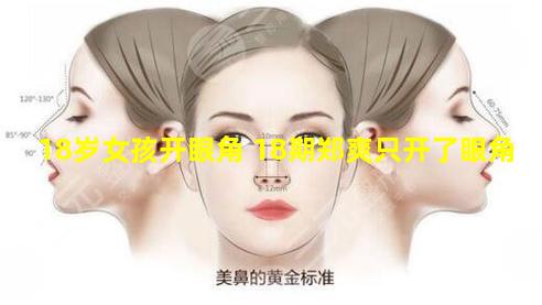 18岁女孩开眼角 18期郑爽只开了眼角